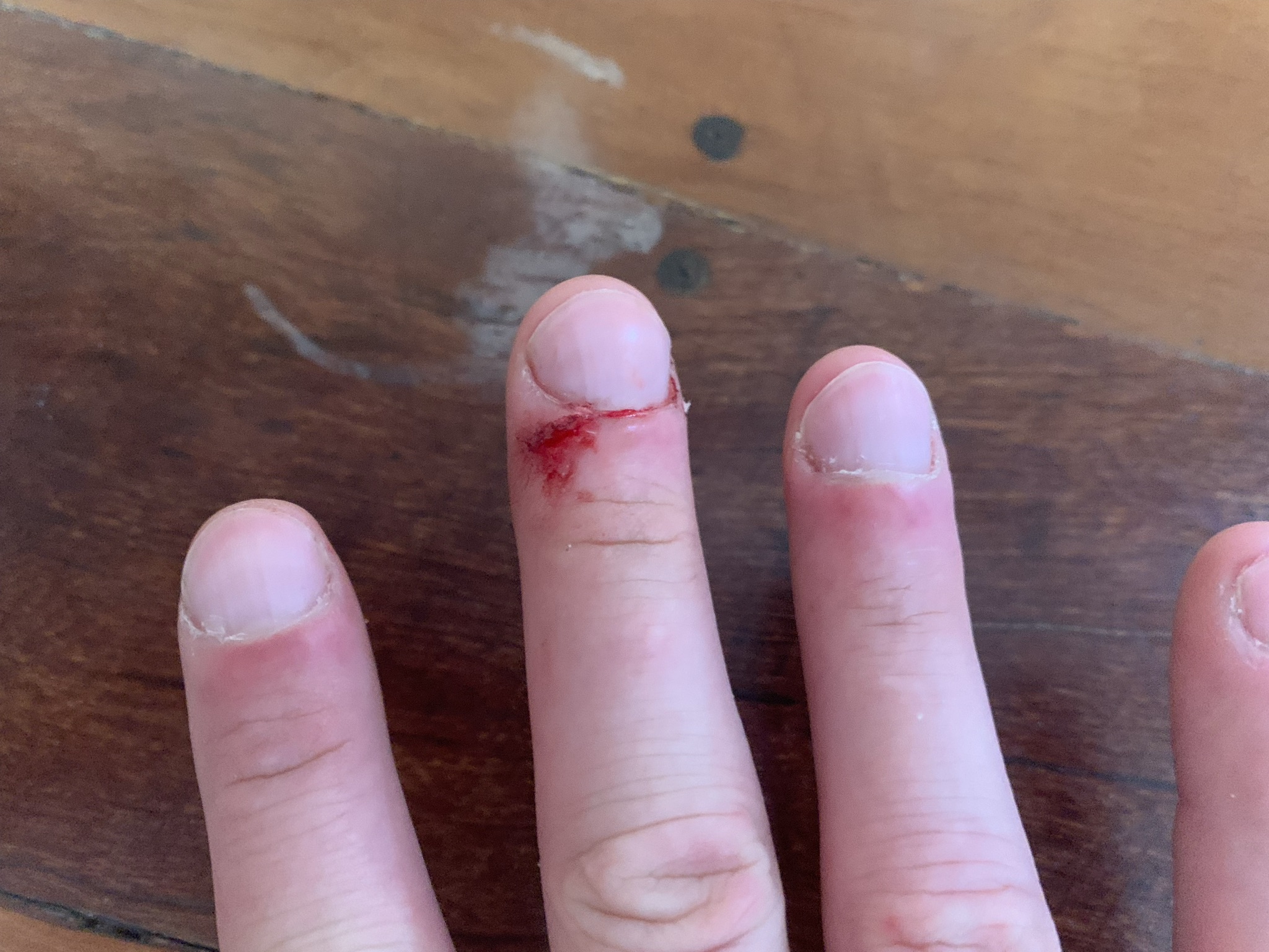 Henry Bit My Finger